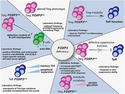 IPEX Syndrome: Improved Knowledge of Immune Pathogenesis Empowers Diagnosis